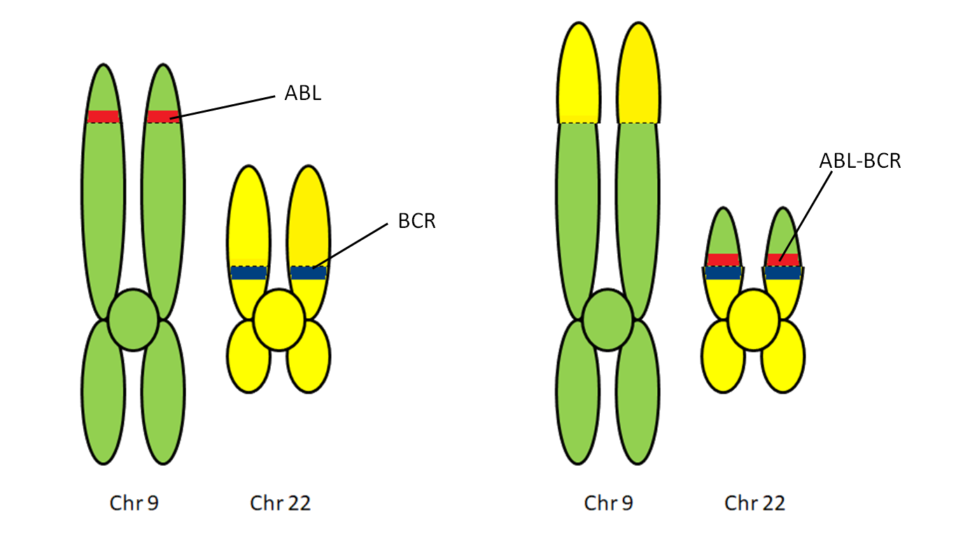 Diagram of the Philadelphia chromosome